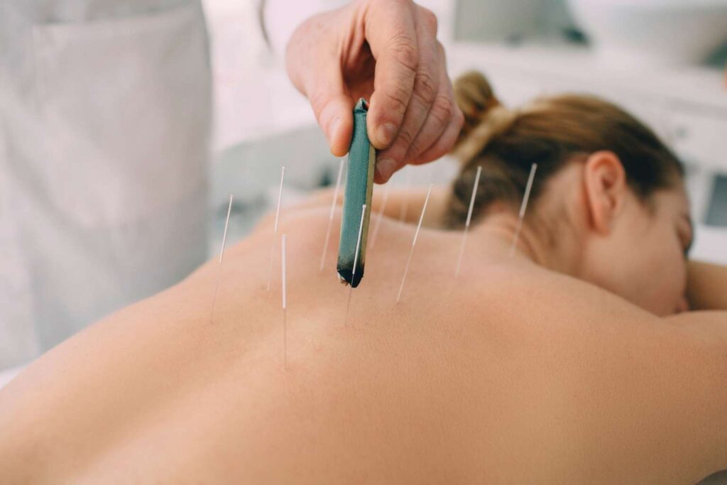 Acupuntura clinica