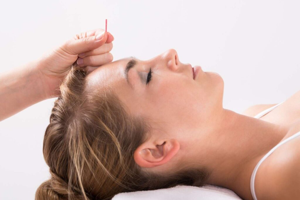 Curso de Acupuntura estética